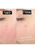 קרם פנים משקם לעור רגיש 28 מ"ל | קיל'ס