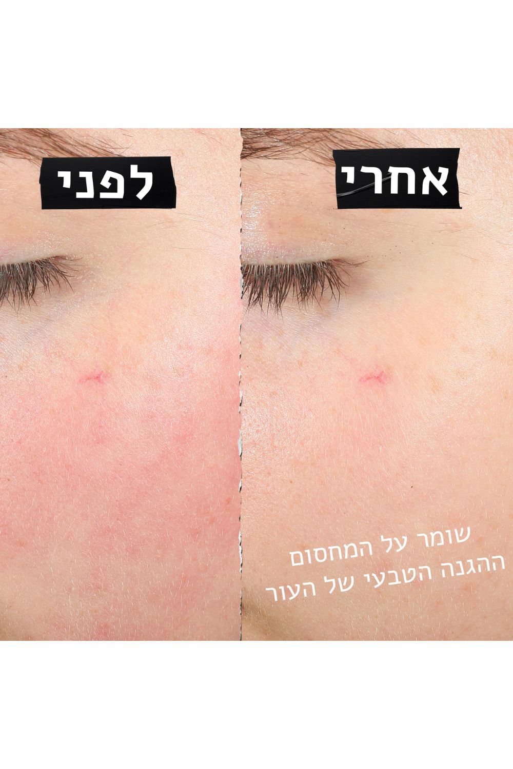 קרם פנים משקם לעור רגיש 28 מ"ל | קיל'ס