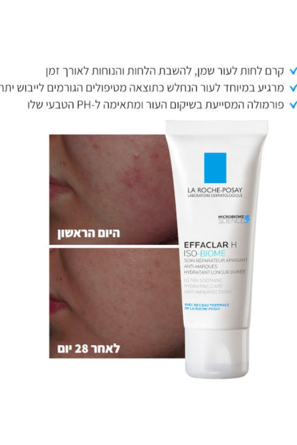 קרם לחות לעור שמן 40 מ"ל | לה רוש פוזה 