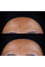 סרום עם רטינול 50 מ"ל Renergie C.R.X Triple