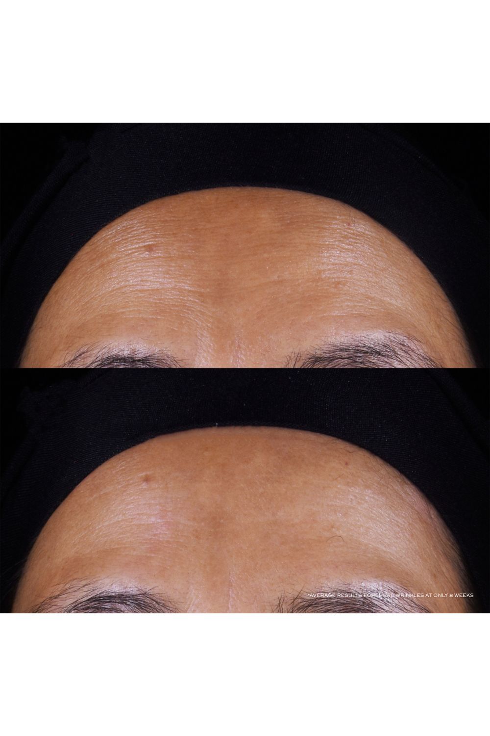 סרום עם רטינול 50 מ"ל Renergie C.R.X Triple