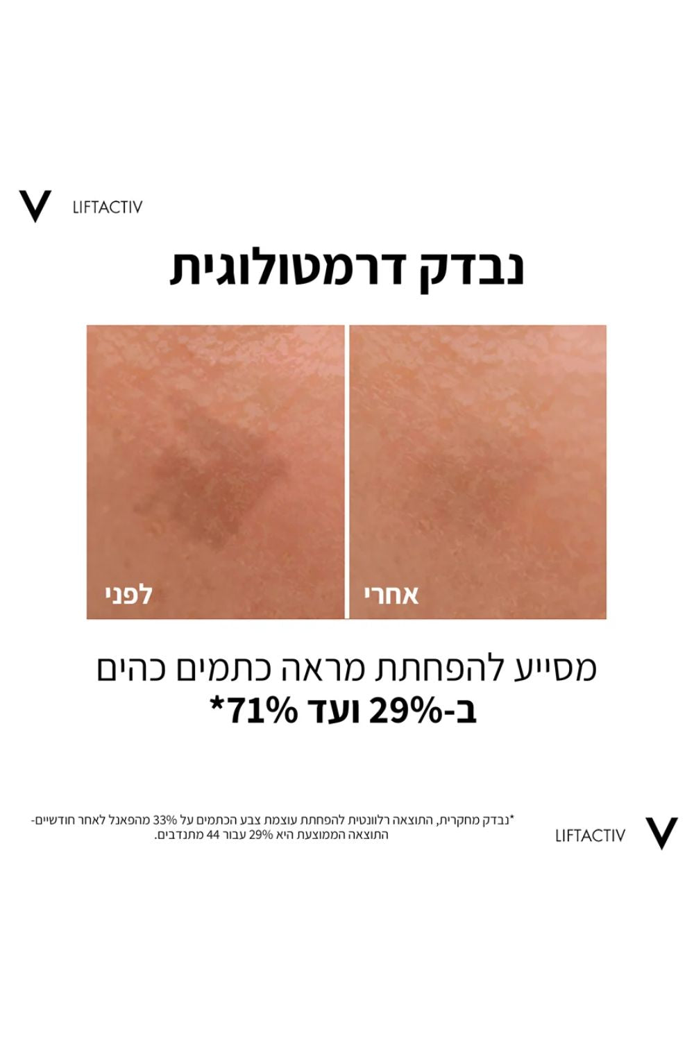סרום לפנים 30 מ"ל B3 | וישי