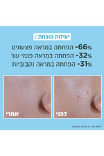 תחליב לחות UV ניאצינאמיד 40 מ"ל