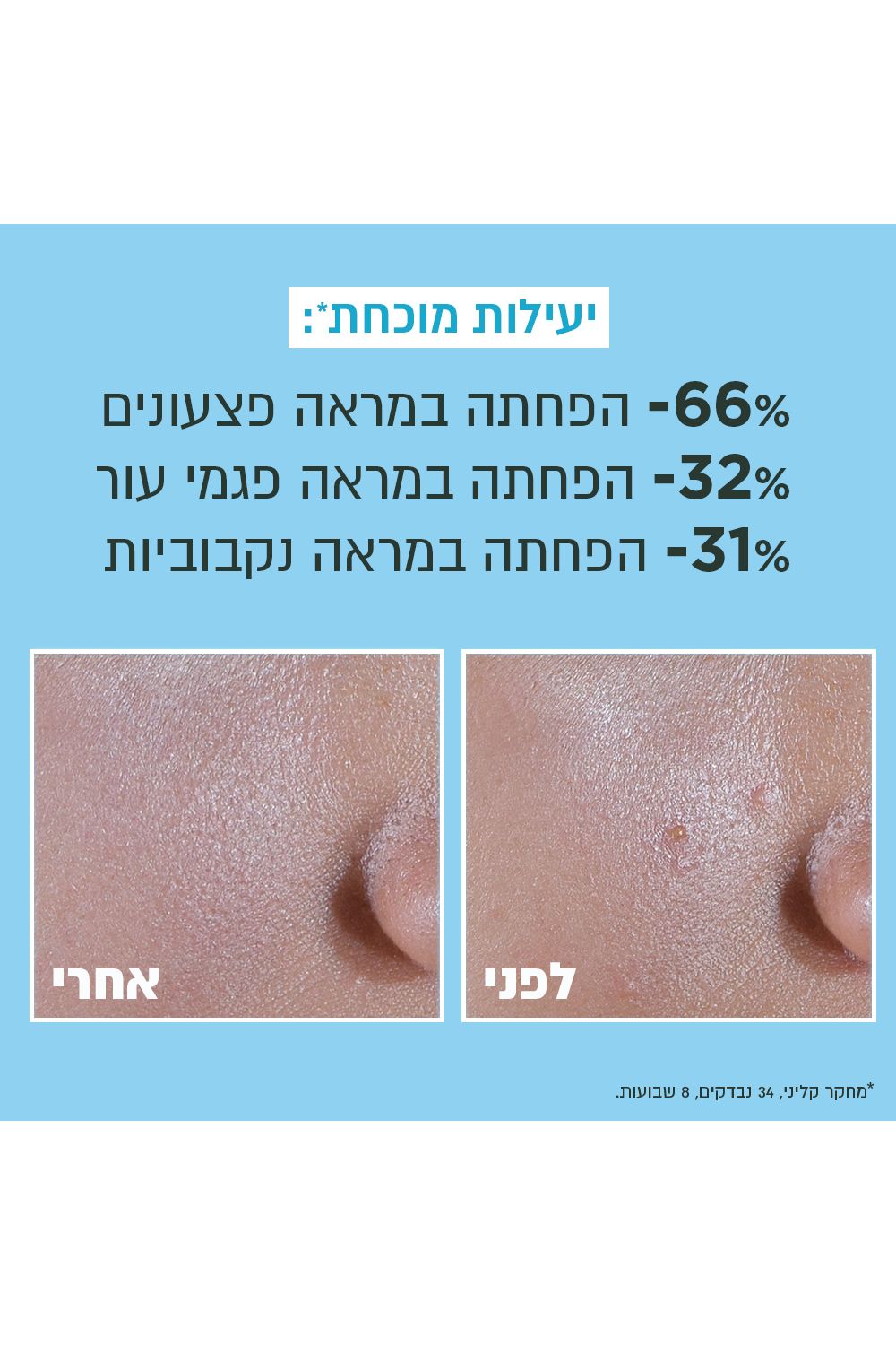 תחליב לחות UV ניאצינאמיד 40 מ"ל