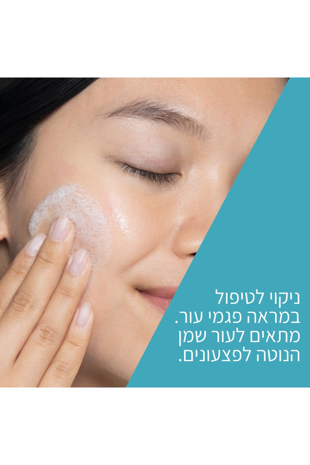 ניקוי לטיפול במראה פגמי העור לעור שמן הנוטה לפצעונים 236 מ"ל | סרווה 