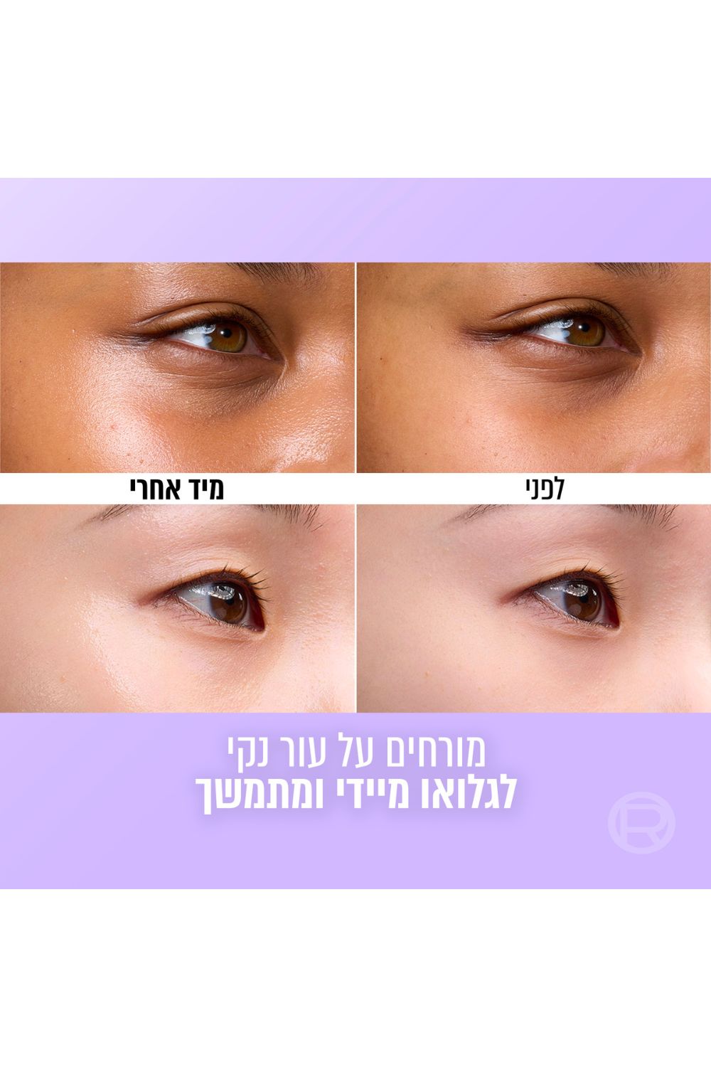 קרם לחות למראה עור זכוכית 50 מ"ל Revitalift filler | לוריאל 