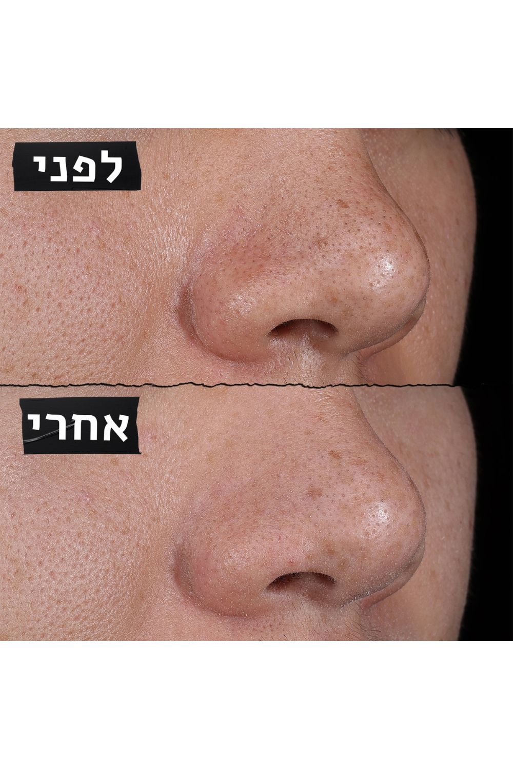מסכת חימר לצמצום מראה הנקבוביות 125 מ"ל | קיל'ס
