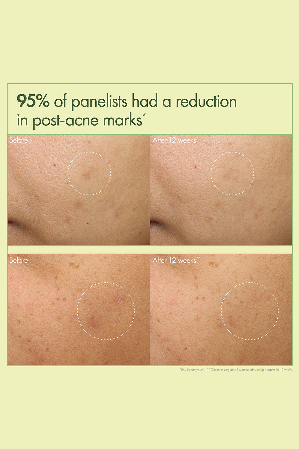 קרם לחות להבהרה ותיקון כתמים כהים בעור 50 מ"ל 