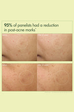 קרם לחות להבהרה ותיקון כתמים כהים בעור 50 מ"ל 