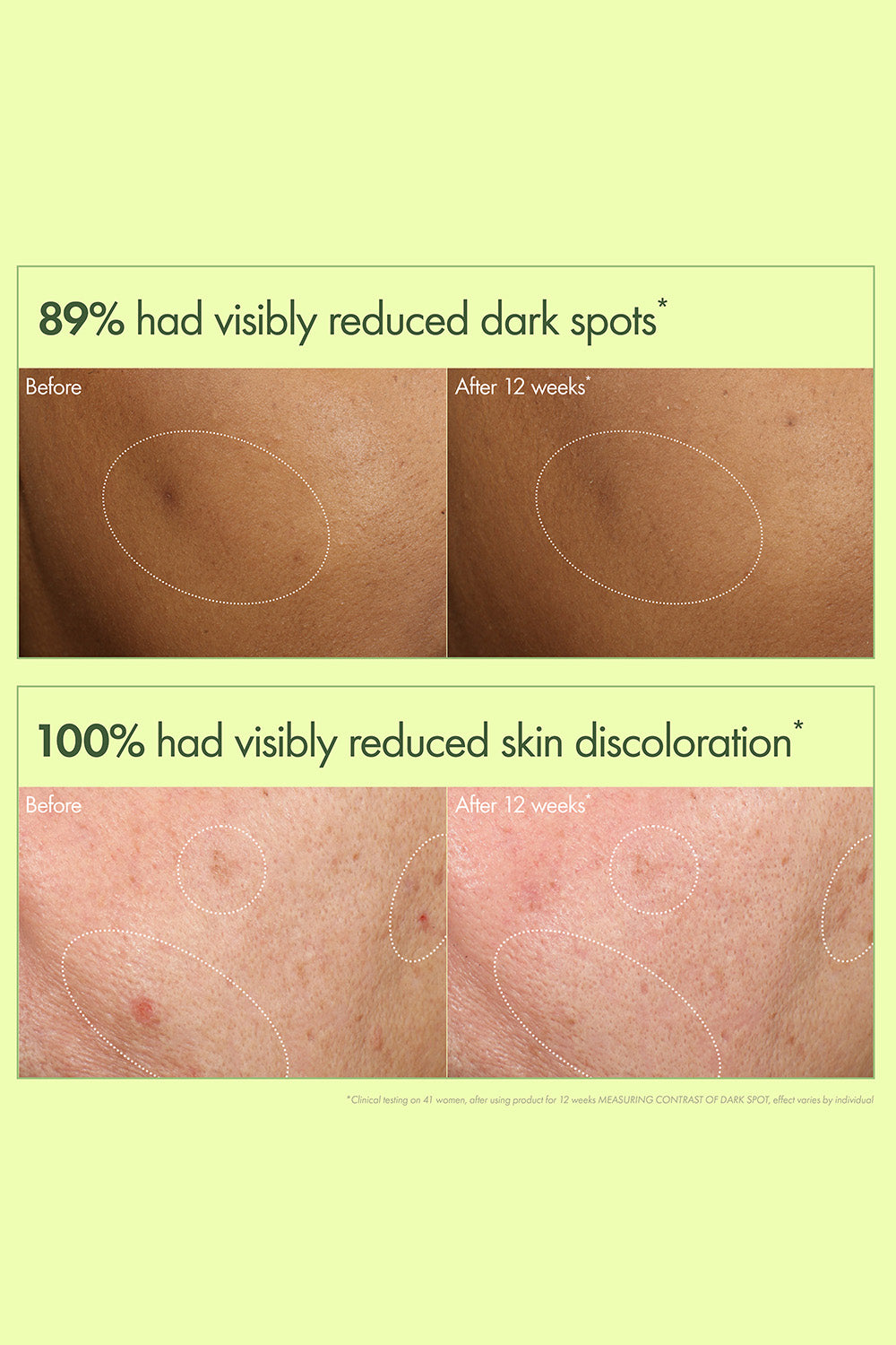 סרום להבהרה ותיקון כתמים כהים בעור