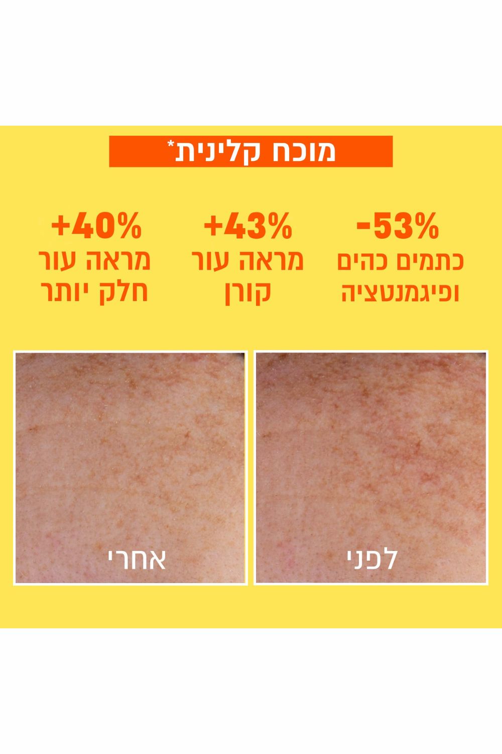 תחליב לחות UV ויטמין C אינביזיבל 40 מ"ל