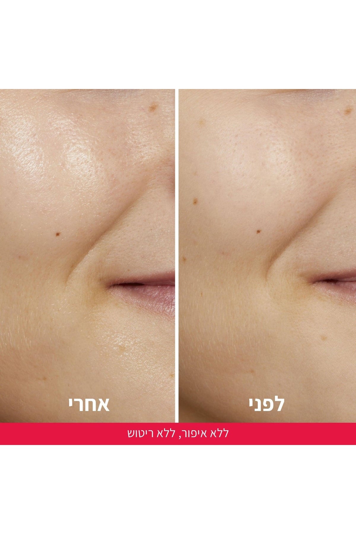 L'Oreal Paris - טונר חומצה גליקולית REVITALIFT 180 מ"ל - MASHBIR//365