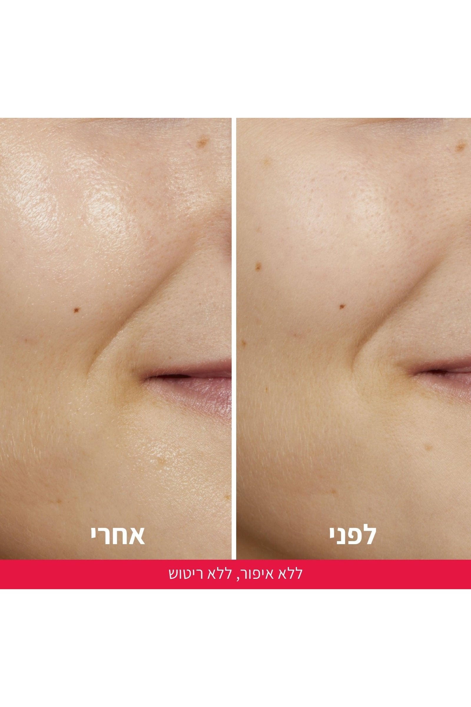 L'Oreal Paris - טונר חומצה גליקולית REVITALIFT 180 מ"ל - MASHBIR//365