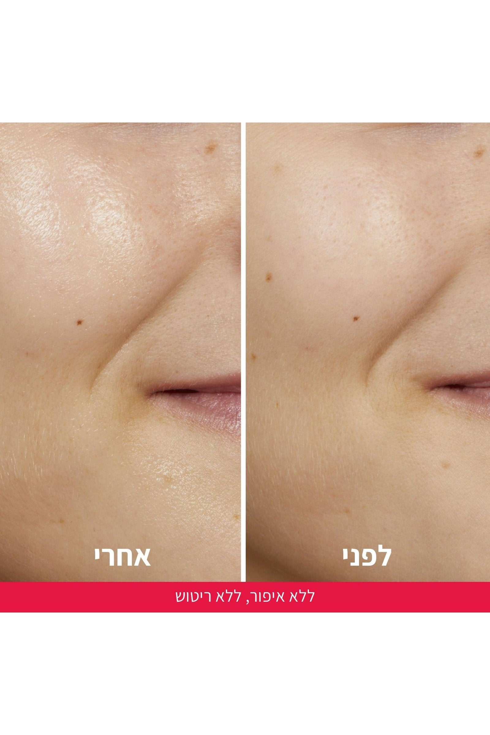 L'Oreal Paris - טונר חומצה גליקולית REVITALIFT 180 מ"ל - MASHBIR//365